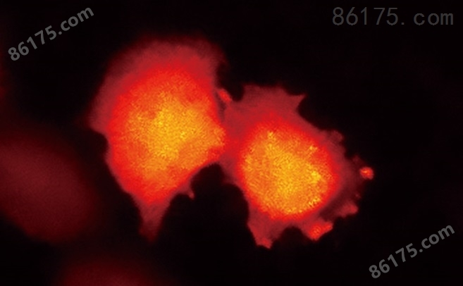 表达基于BRET的钙指示蛋白的HeLa细胞